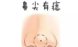 鼻尖有痣到底啥意思？你可能想不到的财运玄