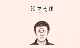 印堂有痣，会带来好运还是麻烦