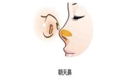 朝天鼻好不好，你需要了解的面相秘密